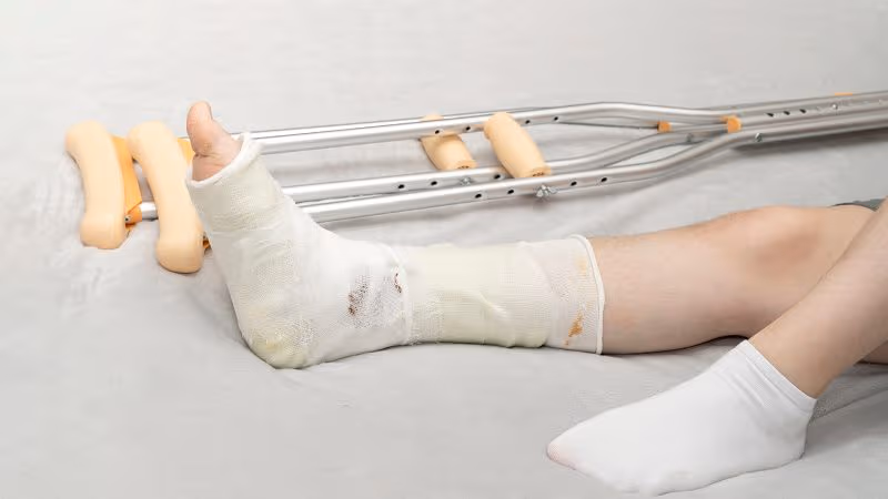 liền xương sau băng bó