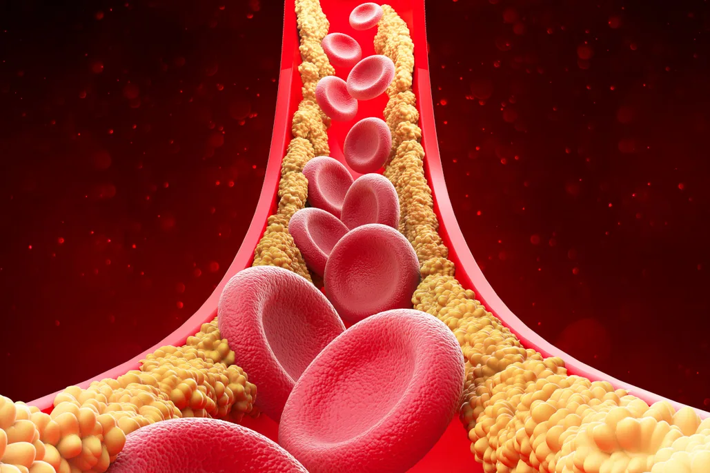 cholesterol là gì
