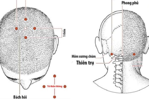 huyệt trên đầu