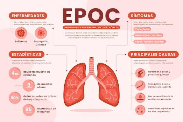 hiệu ứng EPOC