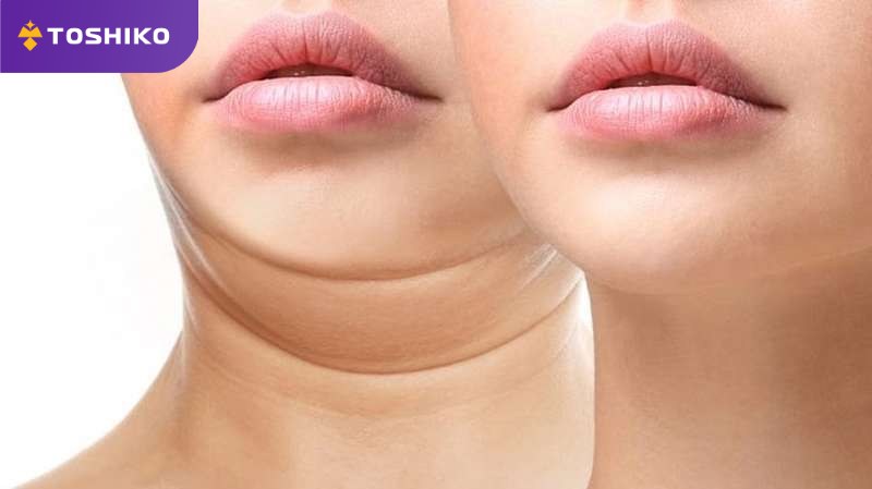 Các phương pháp hỗ trợ giảm mỡ cổ tại nhà 2 Cách giảm mỡ cổ, hết ngấn cổ nhanh và hiệu quả ngay tại nhà